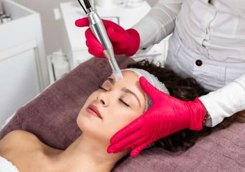 woman lying in bed getting microneedling treatment