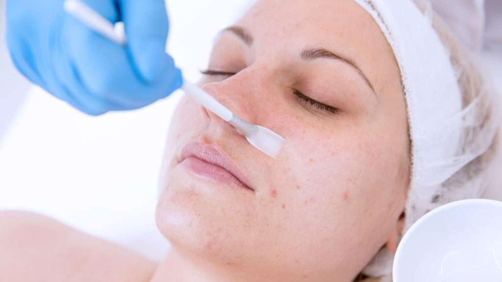 patient getting chemical peel on her face 2