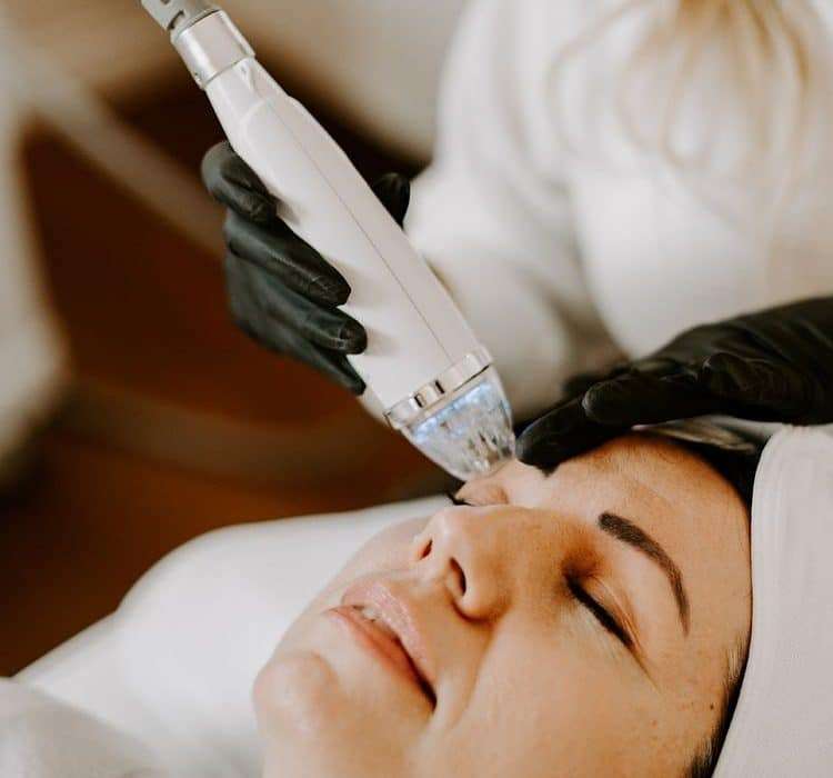 woman lying in bed getting microneedling treatment