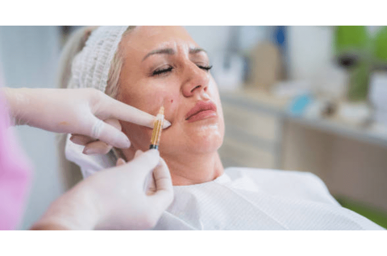 a woman with a sagging cheeks getting her filler treatment