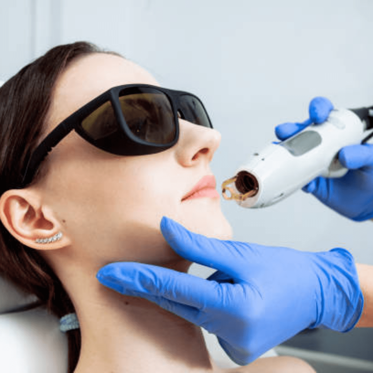 a person getting a laser treatment on their face