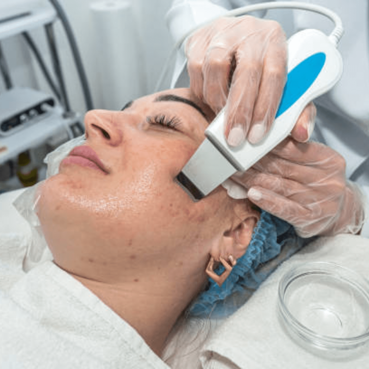 A person getting her facial loss volume treatment