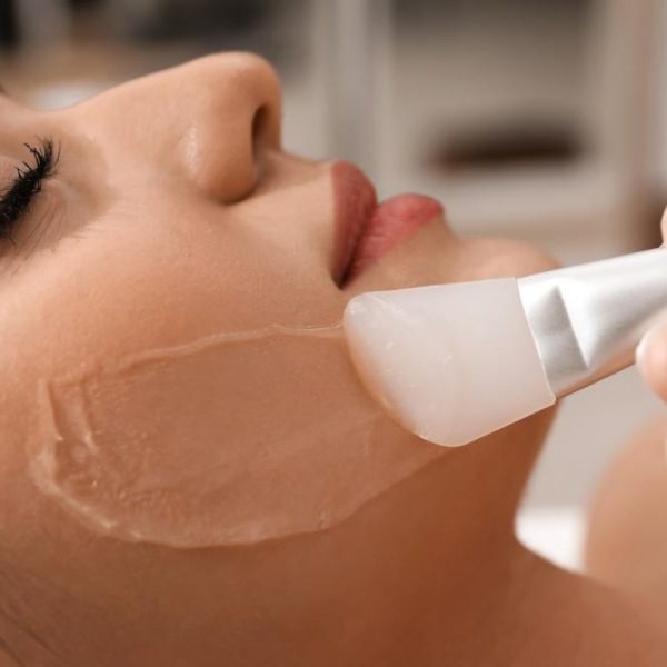 patient getting chemical peel on her face