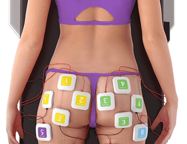 a womans buttocks with electrodes attached to her butt 1