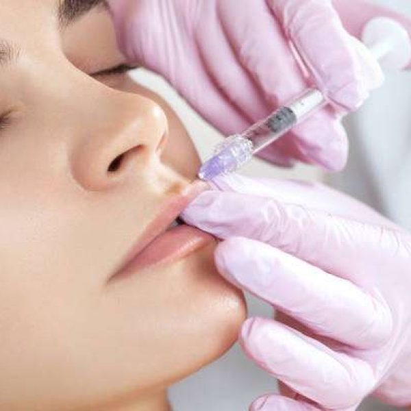 osmetologist makes lip augmentation procedure 1